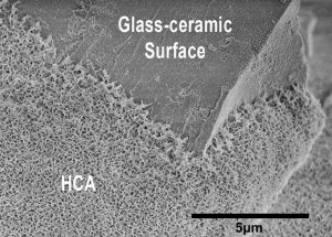 Bioactive Glasses