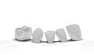 Dental Prostheses